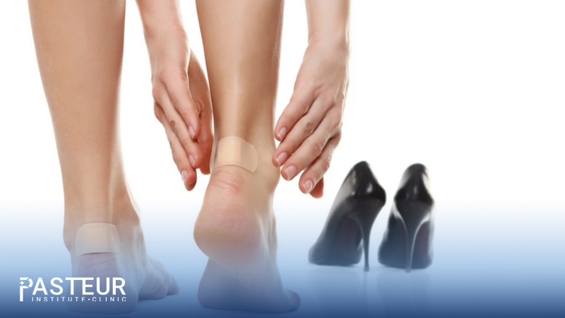 Băng dán urgo có thể sử dụng trước để tránh đau gót chân hoặc sau khi bị chấn thương