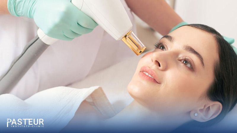 Quá trình chăm sóc da sau trị nám laser góp phần nâng cao hiệu quả chữa nám và phòng tránh rủi ro