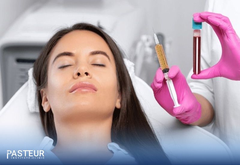 Trị nám bằng laser máu tự thân PRP là phương pháp điều trị nám da mang lại hiệu quả cao và an toàn