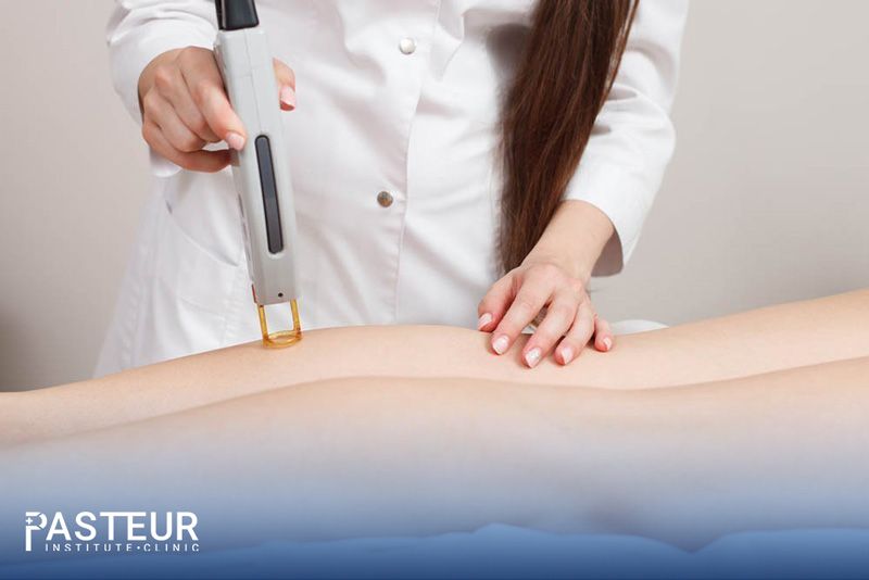 Tia laser được sử dụng phổ biến trong điều trị các bệnh lý về da, trong đó có trị rạn